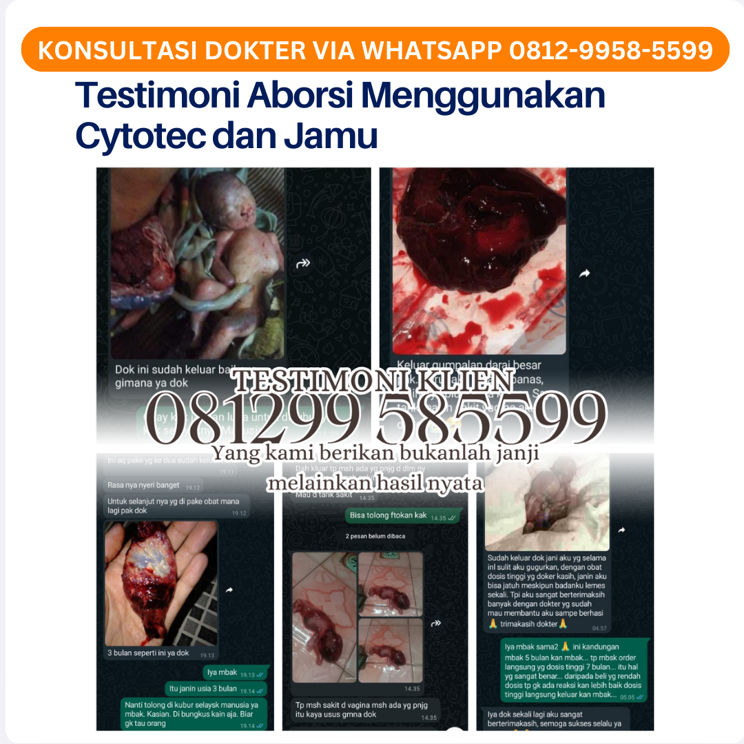 Panduan Lengkap: Cara Cepat Menstruasi dengan Obat Pembersih Rahim 500 mg untuk Siklus Lebih Teratur